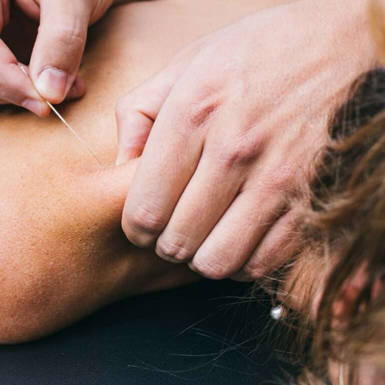 How Physiotherapy Can Relieve Nerve Pain and Restore