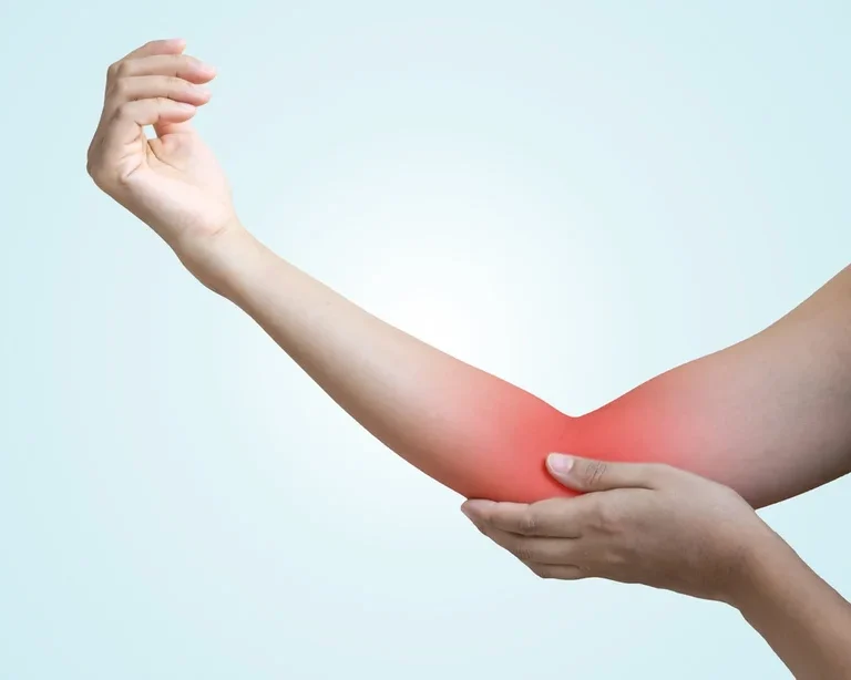 Medial Collateral Ligament (MCL) Injuries of the Elbow