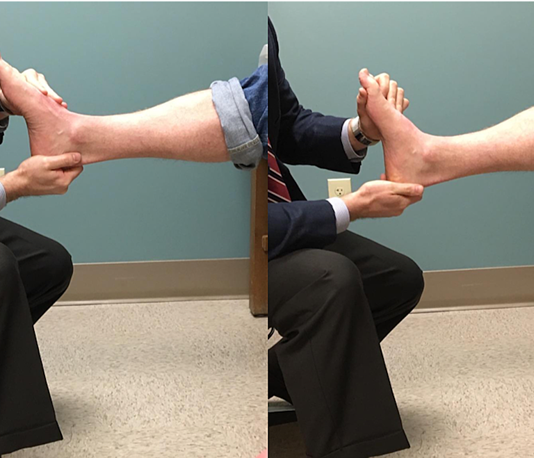 Silfverskiöld Test Explained | Assessing Calf Tightness and Ankle Mobility